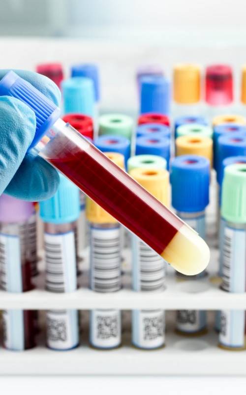 Calcium/KreatininRatio im Urin Endokrinologikum Labore Hamburg