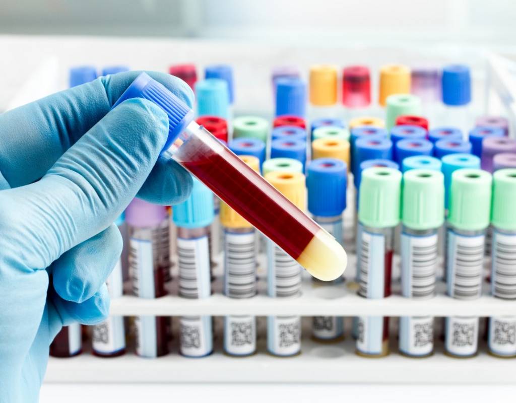 Alkalische Phosphatase Endokrinologikum Labore Hamburg