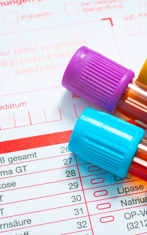 Estradiol Endokrinologikum Labore Hamburg