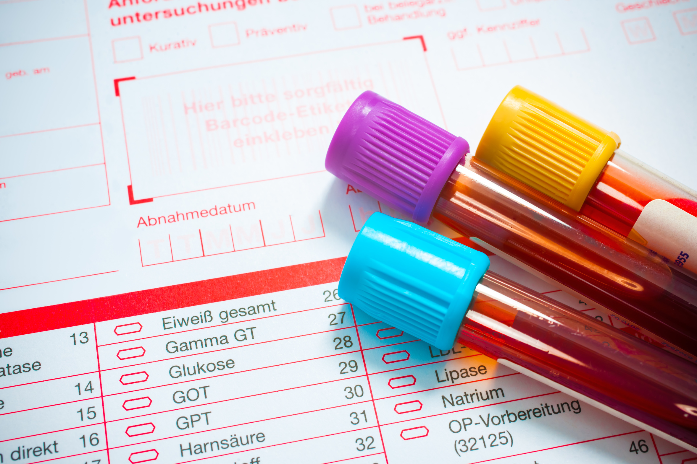 Testosteron, gesamt Endokrinologikum Labore Hamburg
